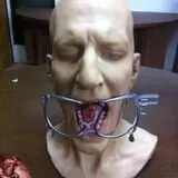 Dental Work